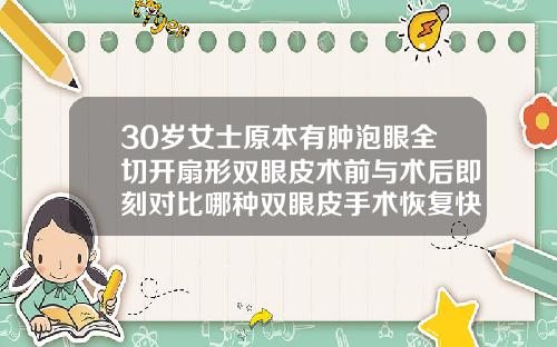 30岁女士原本有肿泡眼全切开扇形双眼皮术前与术后即刻对比哪种双眼皮手术恢复快而且自然