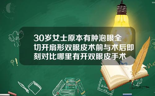 30岁女士原本有肿泡眼全切开扇形双眼皮术前与术后即刻对比哪里有开双眼皮手术