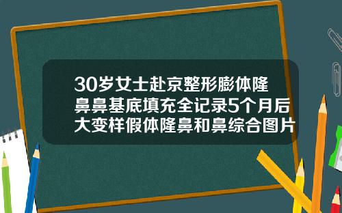 30岁女士赴京整形膨体隆鼻鼻基底填充全记录5个月后大变样假体隆鼻和鼻综合图片