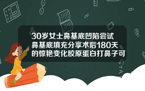 30岁女士鼻基底凹陷尝试鼻基底填充分享术后180天的惊艳变化胶原蛋白打鼻子可以维持多久
