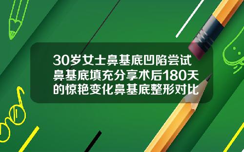 30岁女士鼻基底凹陷尝试鼻基底填充分享术后180天的惊艳变化鼻基底整形对比