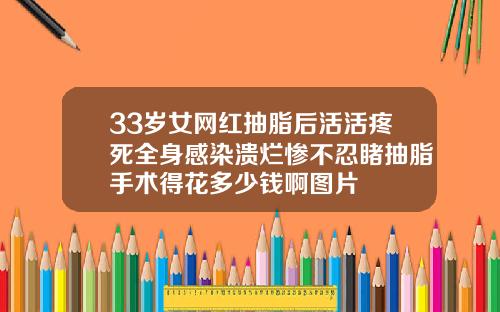 33岁女网红抽脂后活活疼死全身感染溃烂惨不忍睹抽脂手术得花多少钱啊图片