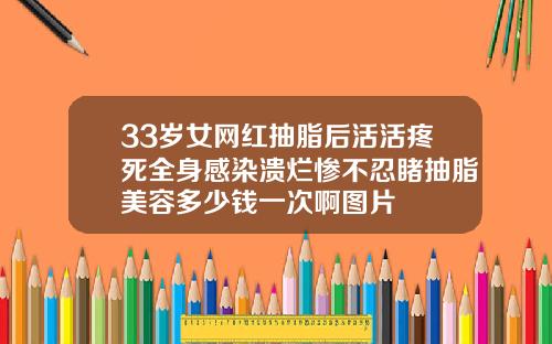 33岁女网红抽脂后活活疼死全身感染溃烂惨不忍睹抽脂美容多少钱一次啊图片