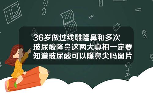 36岁做过线雕隆鼻和多次玻尿酸隆鼻这两大真相一定要知道玻尿酸可以隆鼻尖吗图片