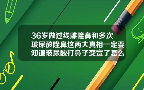 36岁做过线雕隆鼻和多次玻尿酸隆鼻这两大真相一定要知道玻尿酸打鼻子变宽了怎么办图片