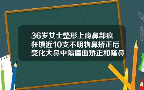 36岁女士整形上瘾鼻部疯狂填近10支不明物鼻矫正后变化大鼻中隔偏曲矫正和隆鼻一起做多少钱一次