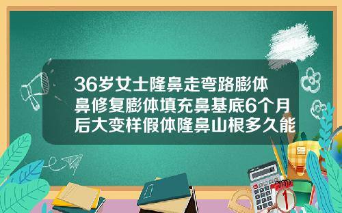 36岁女士隆鼻走弯路膨体鼻修复膨体填充鼻基底6个月后大变样假体隆鼻山根多久能自然
