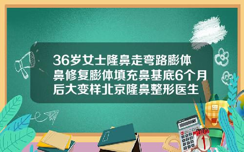 36岁女士隆鼻走弯路膨体鼻修复膨体填充鼻基底6个月后大变样北京隆鼻整形医生