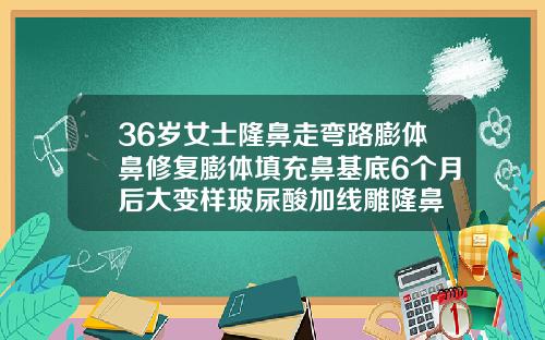 36岁女士隆鼻走弯路膨体鼻修复膨体填充鼻基底6个月后大变样玻尿酸加线雕隆鼻