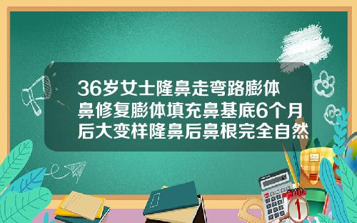 36岁女士隆鼻走弯路膨体鼻修复膨体填充鼻基底6个月后大变样隆鼻后鼻根完全自然要多久