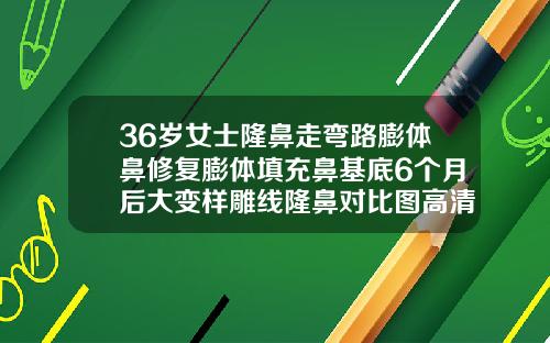 36岁女士隆鼻走弯路膨体鼻修复膨体填充鼻基底6个月后大变样雕线隆鼻对比图高清