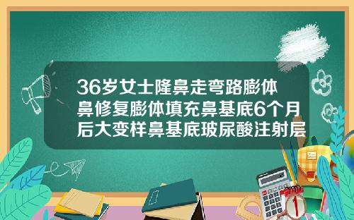 36岁女士隆鼻走弯路膨体鼻修复膨体填充鼻基底6个月后大变样鼻基底玻尿酸注射层次