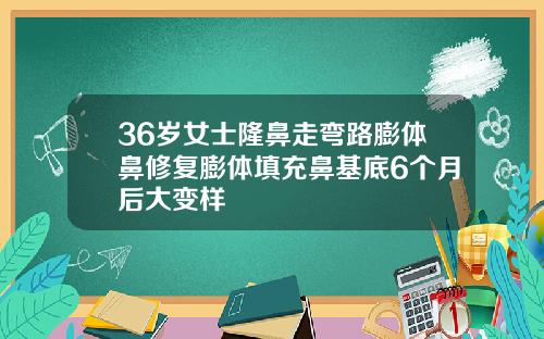 36岁女士隆鼻走弯路膨体鼻修复膨体填充鼻基底6个月后大变样