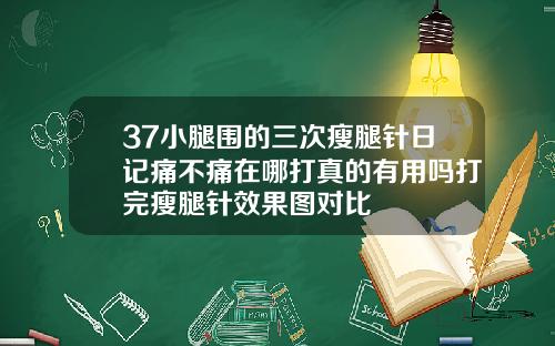 37小腿围的三次瘦腿针日记痛不痛在哪打真的有用吗打完瘦腿针效果图对比
