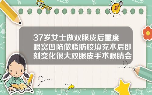 37岁女士做双眼皮后重度眼窝凹陷做脂肪胶填充术后即刻变化很大双眼皮手术眼睛会变大吗