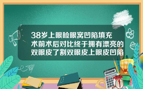 38岁上眼睑眼窝凹陷填充术前术后对比终于拥有漂亮的双眼皮了割双眼皮上眼皮凹陷