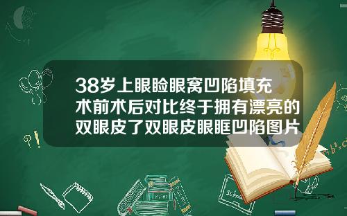 38岁上眼睑眼窝凹陷填充术前术后对比终于拥有漂亮的双眼皮了双眼皮眼眶凹陷图片