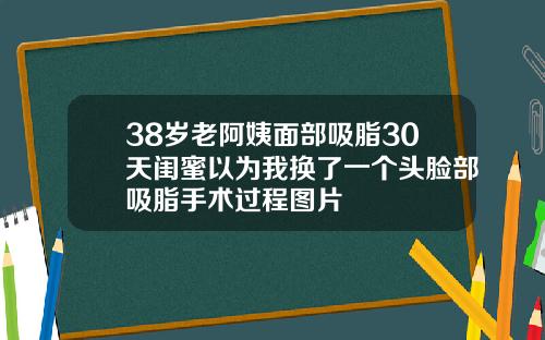 38岁老阿姨面部吸脂30天闺蜜以为我换了一个头脸部吸脂手术过程图片