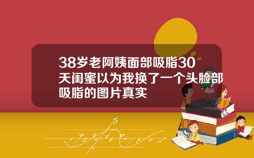 38岁老阿姨面部吸脂30天闺蜜以为我换了一个头脸部吸脂的图片真实