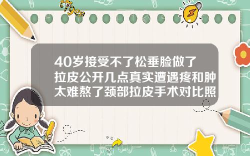 40岁接受不了松垂脸做了拉皮公开几点真实遭遇疼和肿太难熬了颈部拉皮手术对比照片