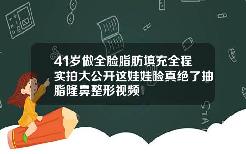41岁做全脸脂肪填充全程实拍大公开这娃娃脸真绝了抽脂隆鼻整形视频