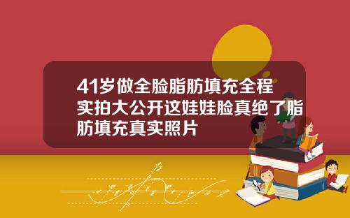41岁做全脸脂肪填充全程实拍大公开这娃娃脸真绝了脂肪填充真实照片