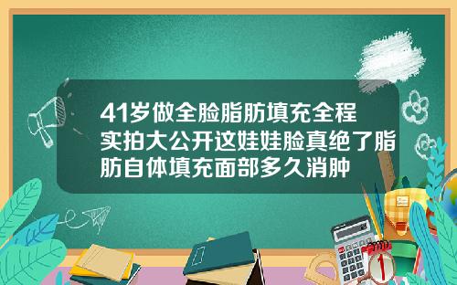 41岁做全脸脂肪填充全程实拍大公开这娃娃脸真绝了脂肪自体填充面部多久消肿