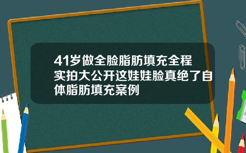 41岁做全脸脂肪填充全程实拍大公开这娃娃脸真绝了自体脂肪填充案例