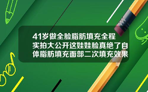 41岁做全脸脂肪填充全程实拍大公开这娃娃脸真绝了自体脂肪填充面部二次填充效果
