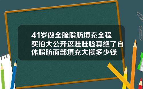 41岁做全脸脂肪填充全程实拍大公开这娃娃脸真绝了自体脂肪面部填充大概多少钱