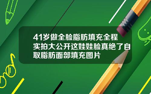 41岁做全脸脂肪填充全程实拍大公开这娃娃脸真绝了自取脂肪面部填充图片