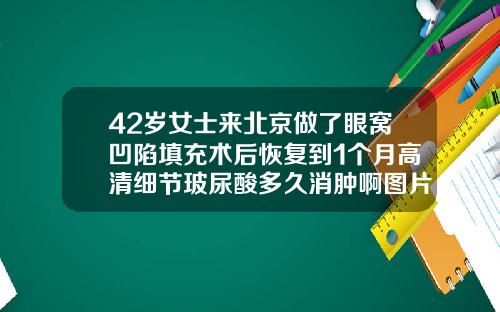 42岁女士来北京做了眼窝凹陷填充术后恢复到1个月高清细节玻尿酸多久消肿啊图片