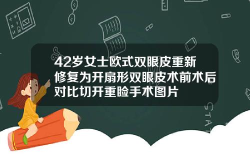 42岁女士欧式双眼皮重新修复为开扇形双眼皮术前术后对比切开重睑手术图片