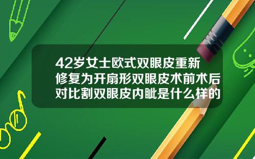 42岁女士欧式双眼皮重新修复为开扇形双眼皮术前术后对比割双眼皮内眦是什么样的
