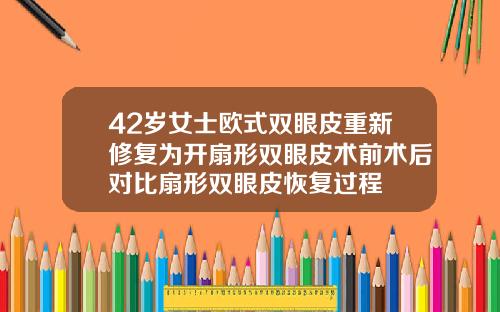 42岁女士欧式双眼皮重新修复为开扇形双眼皮术前术后对比扇形双眼皮恢复过程