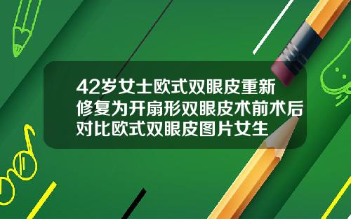 42岁女士欧式双眼皮重新修复为开扇形双眼皮术前术后对比欧式双眼皮图片女生