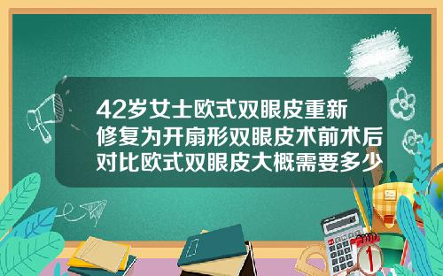 42岁女士欧式双眼皮重新修复为开扇形双眼皮术前术后对比欧式双眼皮大概需要多少钱做