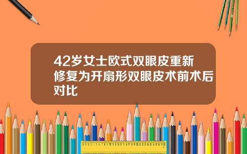 42岁女士欧式双眼皮重新修复为开扇形双眼皮术前术后对比