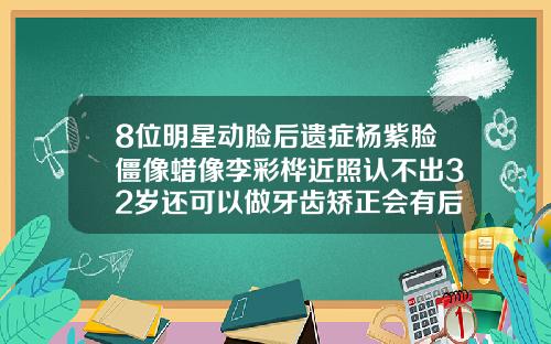 8位明星动脸后遗症杨紫脸僵像蜡像李彩桦近照认不出32岁还可以做牙齿矫正会有后遗症吗