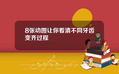 8张动图让你看清不同牙齿变齐过程