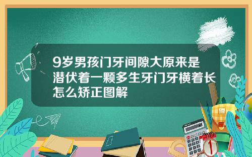 9岁男孩门牙间隙大原来是潜伏着一颗多生牙门牙横着长怎么矫正图解