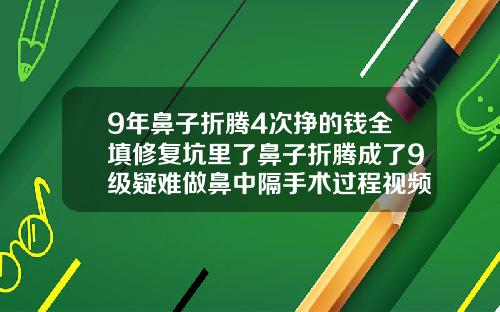 9年鼻子折腾4次挣的钱全填修复坑里了鼻子折腾成了9级疑难做鼻中隔手术过程视频
