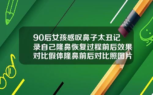 90后女孩感叹鼻子太丑记录自己隆鼻恢复过程前后效果对比假体隆鼻前后对比照图片