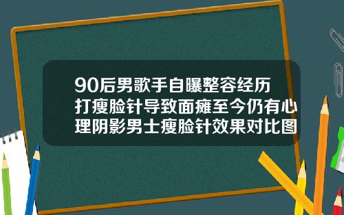 90后男歌手自曝整容经历打瘦脸针导致面瘫至今仍有心理阴影男士瘦脸针效果对比图