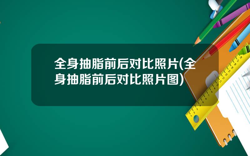 全身抽脂前后对比照片(全身抽脂前后对比照片图)